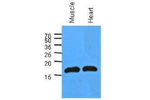 Image no. 1 for anti-Myoglobin (MB) (AA 1-154), (N-Term) antibody (ABIN953585) (Myoglobin anticorps  (N-Term))