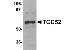 Western Blotting (WB) image for anti-DDB1 and CUL4 Associated Factor 12 (DCAF12) (C-Term) antibody (ABIN1030723) (DCAF12 anticorps  (C-Term))