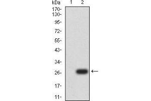 Western Blotting (WB) image for anti-Uncoupling Protein 3 (Mitochondrial, Proton Carrier) (UCP3) (AA 1-113), (AA 217-312) antibody (ABIN5871957) (UCP3 anticorps  (AA 1-113, AA 217-312))
