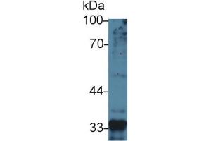 Mouse Capture antibody from the kit in WB with Positive Control: Sample Human Liver lysate.