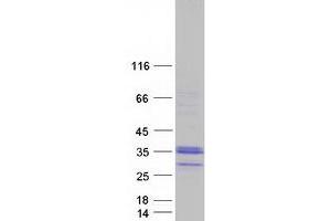 Validation with Western Blot