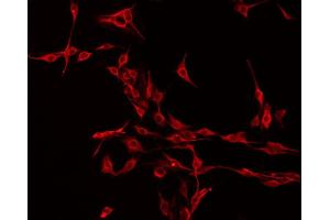 ABIN6275303 staining Hela by IF/ICC. (NMS anticorps  (C-Term))