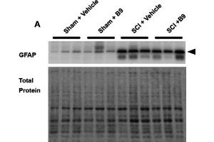 Western blot showing a band at the molecular weight corresponding to GFAP (cat. (GFAP anticorps  (AA 411-422))