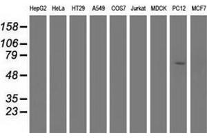 Western blot analysis of extracts (35 µg) from 9 different cell lines by using anti-EPM2AIP1 monoclonal antibody.
