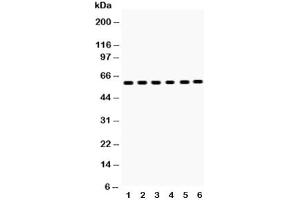 Western blot testing of EAAT2 antibody and Lane 1:  rat brain (SLC1A2 anticorps  (AA 461-574))