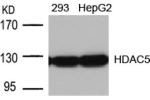 Image no. 1 for anti-Histone Deacetylase 5 (HDAC5) (AA 496-500) antibody (ABIN197340) (HDAC5 anticorps  (AA 496-500))