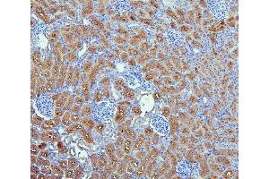 IHC analysis of SLC9A3R1 using anti-SLC9A3R1 antibody (ABIN6719642).