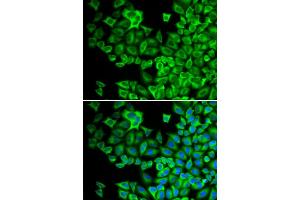 Immunofluorescence analysis of A549 cells using HCK antibody (ABIN5971109). (HCK anticorps)