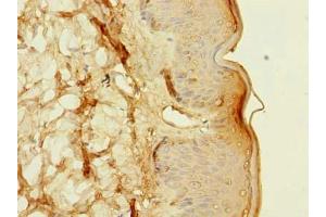 Immunohistochemistry of paraffin-embedded human skin tissue using ABIN7153252 at dilution of 1:100