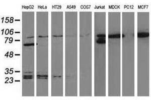 Image no. 6 for anti-Catenin (Cadherin-Associated Protein), beta 1, 88kDa (CTNNB1) antibody (ABIN1496890) (CTNNB1 anticorps)