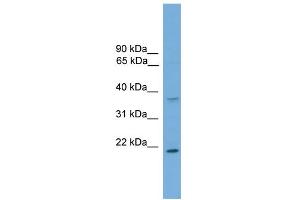 WB Suggested Anti-GSTM1 Antibody Titration:  0.