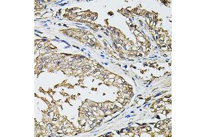 Immunohistochemistry of paraffin-embedded human prostate using RASSF5 antibody (ABIN4904957) at dilution of 1:100 (40x lens). (RASSF5 anticorps)