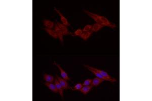 Immunofluorescence analysis of PC-12 using Cortactin antibody (ABIN6127722, ABIN6139243, ABIN6139244 and ABIN6221478) at dilution of 1:25 (40x lens).