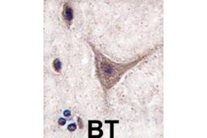Immunohistochemistry (IHC) image for anti-Cadherin 10, Type 2 (T2-Cadherin) (CDH10) antibody (ABIN2998269)
