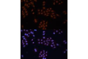 Immunofluorescence analysis of HeLa cells using GTF2I antibody (ABIN6129629, ABIN6141510, ABIN6141512 and ABIN6216068) at dilution of 1:100.