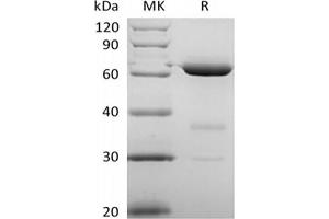 Western Blotting (WB) image for 5'-Nucleotidase, Ecto (CD73) (NT5E) (Active) protein (His tag) (ABIN7319774) (CD73 Protein (His tag))