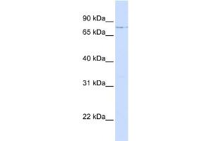 WB Suggested Anti-LCP1 Antibody Titration: 0. (LCP1 anticorps  (N-Term))