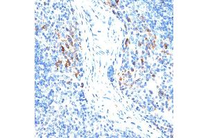 Immunohistochemistry of paraffin-embedded mouse spleen using MMP9 antibody (ABIN6131951, ABIN6143920, ABIN6143923 and ABIN6213777) at dilution of 1:100 (40x lens).