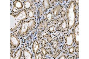 IHC analysis of MRE11 using anti-MRE11 antibody (ABIN7601056). (Mre11 anticorps  (AA 278-498))