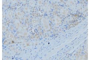 ABIN6279339 at 1/100 staining Mouse kidney tissue by IHC-P. (DYNC1I2 anticorps  (N-Term))