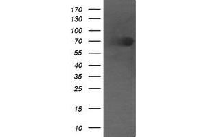 Image no. 1 for anti-Differentially Expressed in FDCP 6 Homolog (DEF6) antibody (ABIN1497811) (DEF6 anticorps)