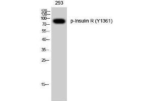 Western Blotting (WB) image for anti-Insulin Receptor (INSR) (pTyr1361) antibody (ABIN3173234) (Insulin Receptor anticorps  (pTyr1361))