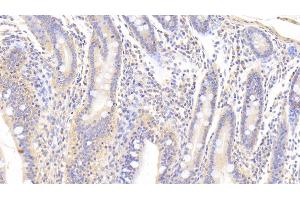 Detection of TGFb3 in Porcine Small intestine Tissue using Polyclonal Antibody to Transforming Growth Factor Beta 3 (TGFb3)