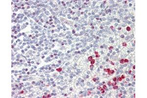 IHC-P Image GNAQ antibody detects GNAQ protein at cytoplasm on human placenta by immunohistochemical analysis.