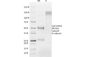 SDS-PAGE Analysis Purified Histone H1 Mouse Monoclonal Antibody (AE-4).