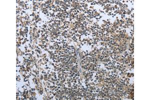 Immunohistochemistry of Human tonsil using PRL Polyclonal Antibody at dilution of 1:30 (Prolactin anticorps)