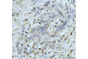 IHC analysis of GP210/NUP210 using anti-GP210/NUP210 antibody (ABIN7600707). (NUP210 anticorps  (AA 221-1724))