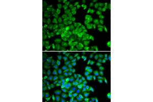 Immunofluorescence analysis of U2OS cells using TCP1 antibody. (TCP1 alpha/CCTA anticorps  (AA 307-556))