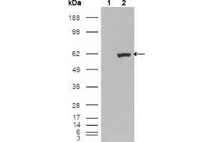 Western blot analysis using ETV1 mouse mAb against HEK293T cells transfected with the pCMV6-ENTRY control (1) and pCMV6-ENTRY ETV1 cDNA (2). (ETV1 anticorps)