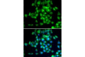 Immunofluorescence analysis of MCF-7 cells using SIRT3 antibody.