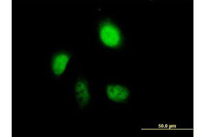 Immunofluorescence of purified MaxPab antibody to ANXA7 on HeLa cell. (Annexin VII anticorps  (AA 1-466))