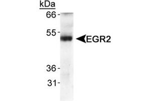 Western blot analysis of EGR2 in human fetal lung tissue using EGR2 polyclonal antibody . (EGR2 anticorps  (AA 200-300))