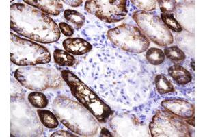 Image no. 1 for anti-Carbonic Anhydrase 12 (CA12) antibody (ABIN1497068)