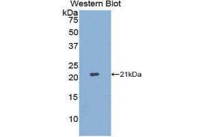 Western blot analysis of the recombinant protein. (Aconitase 1 anticorps  (AA 26-189))
