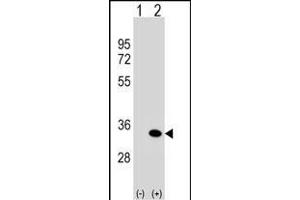 Western blot analysis of G5L (arrow) using rabbit polyclonal G5L Antibody  1812b.