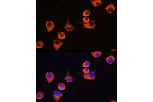 Immunofluorescence analysis of L929 cells using MFI2 Rabbit pAb (ABIN6131379, ABIN6143795, ABIN6143796 and ABIN6222350) at dilution of 1:100 (40x lens). (MFI2 anticorps  (AA 20-200))