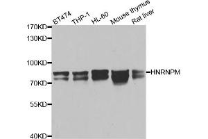 Western blot analysis of extracts of various cell lines, using HNRNPM antibody (ABIN5975447) at 1/1000 dilution. (HNRNPM anticorps)