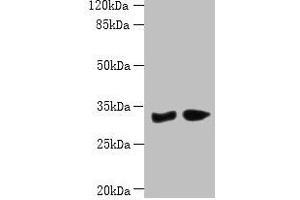 Western blot All lanes: PBLD antibody at 6 μg/mL Lane 1: Mouse liver tissue Lane 2: Mouse kidney tissue Secondary Goat polyclonal to rabbit IgG at 1/10000 dilution Predicted band size: 32 kDa Observed band size: 32 kDa (PBLD1 anticorps  (AA 11-288))