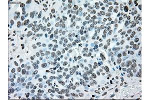 Image no. 7 for anti-B-Raf proto-oncogene, serine/threonine kinase (BRAF) antibody (ABIN1496961)