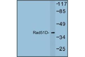 Image no. 1 for anti-RAD51 Homolog D (RAD51D) antibody (ABIN317685) (RAD51D anticorps)