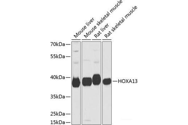 HOXA13 antibody