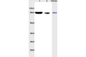 Lane 1: rat heart lysates Lane 2: rat brain lysates probed with Anti phospho-STAT3(Ser727) Polyclonal Antibody, Unconjugated (ABIN746198) at 1:200 in 4 °C.