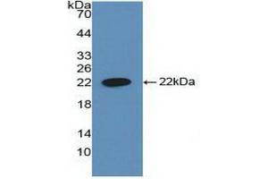 Detection of Recombinant CYFRA21-1, Human using Polyclonal Antibody to Cytokeratin Fragment Antigen 21-1 (CYFRA21-1) (CYFRA21.1 anticorps  (AA 244-400))