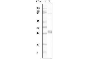 anti-NPT antibody