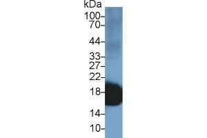 Detection of SOD1 in Rabbit Lung lysate using Polyclonal Antibody to Superoxide Dismutase 1 (SOD1)