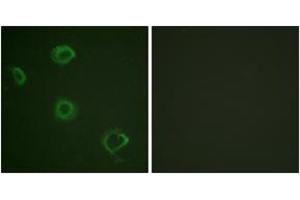 Immunofluorescence analysis of A549 cells, using Interferon-gamma Receptor alpha (Phospho-Tyr457) Antibody. (IFNGR1 anticorps  (pTyr457))